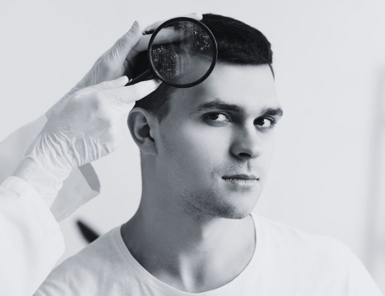 Scalp Exfoliation: The Most Overlooked Step