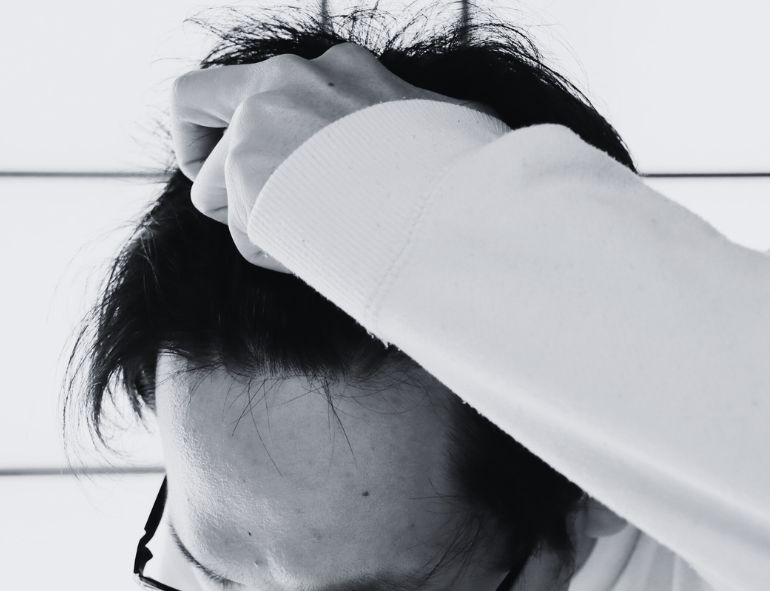 How Stress Causes Hair Loss